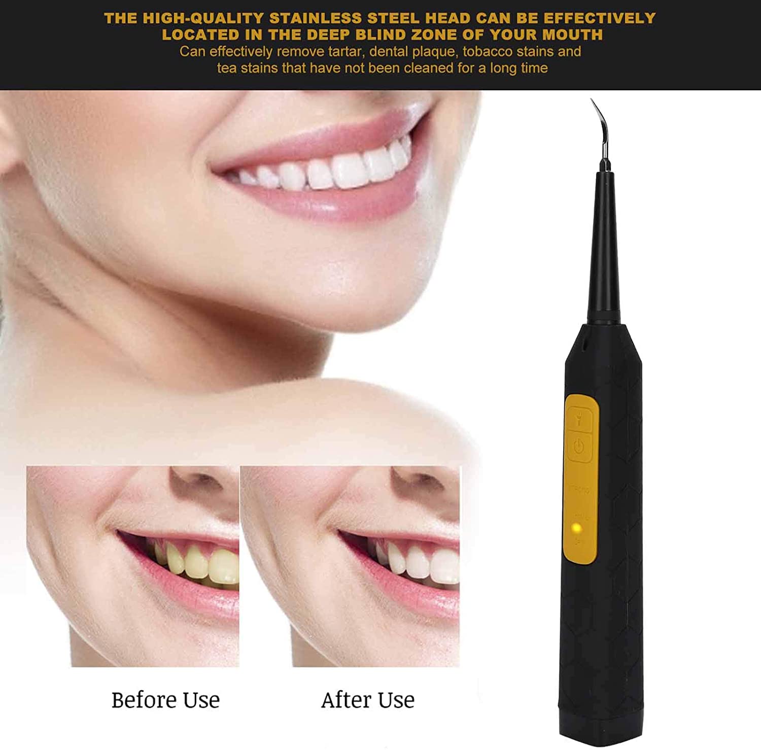 Electric Dental Calculus Remover and Teeth Cleaner - ( Black )
